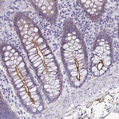 Immunohistochemistry-Paraffin: PIGZ Antibody [NBP2-32394]