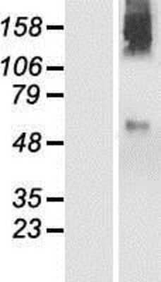 Western Blot: PIGZ Overexpression Lysate [NBP2-06234]