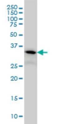 Western Blot: PIH1D1 Antibody (1E8) [H00055011-M06]