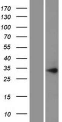 Western Blot: PIH1D1 Overexpression Lysate [NBP2-06900]