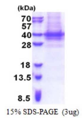 SDS-PAGE: Recombinant Human PIH1D1 His Protein [NBP2-23332]