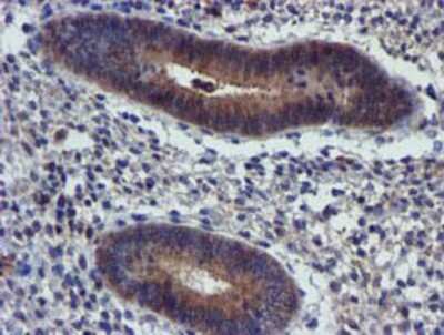 Immunohistochemistry-Paraffin: PIH1D2 Antibody (OTI4A10) [NBP2-03656]