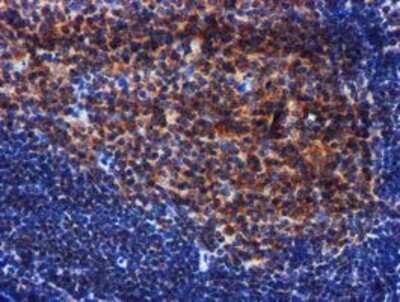Immunohistochemistry: PIH1D2 Antibody (OTI4A10) - Azide and BSA Free [NBP2-73403]