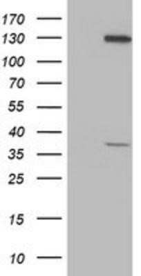 Western Blot: PIH1D2 Antibody (OTI4A10)Azide and BSA Free [NBP2-73403]