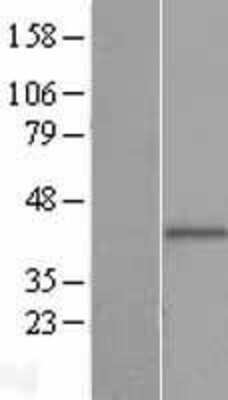 Western Blot: PIH1D2 Overexpression Lysate [NBL1-14413]