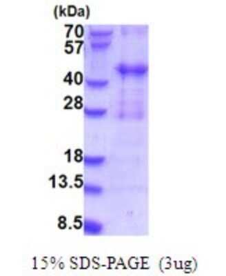 SDS-PAGE: Recombinant Human PIH1D2 His Protein [NBP2-51879]