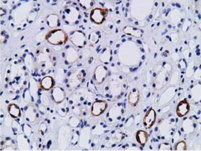 Immunohistochemistry-Paraffin: BCAP/PIK3AP1 Antibody (OTI7A11) [NBP2-03109]