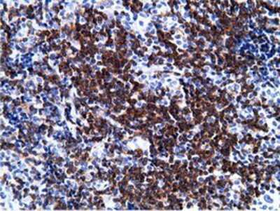 Immunohistochemistry-Paraffin: BCAP/PIK3AP1 Antibody (OTI7A11) [NBP2-03109]