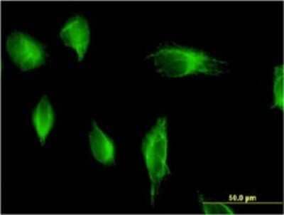 Immunocytochemistry/ Immunofluorescence: PIK3C2A Antibody (3E7) [H00005286-M05]