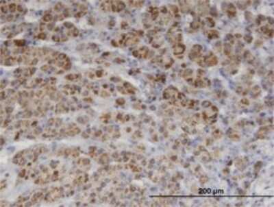 Immunohistochemistry-Paraffin: PIK3C2A Antibody (3E7) [H00005286-M05]