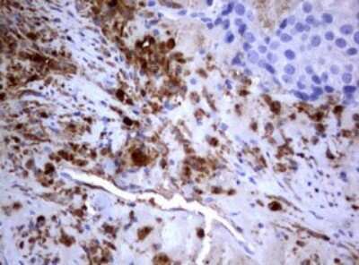 Immunohistochemistry: PIK3C2A Antibody (OTI3H2) [NBP2-46395]