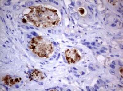 Immunohistochemistry: PIK3C2A Antibody (OTI3H2) [NBP2-46395]
