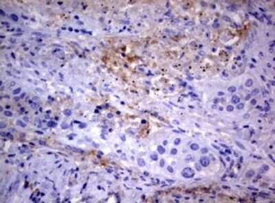 Immunohistochemistry: PIK3C2A Antibody (OTI3H2) [NBP2-46395]
