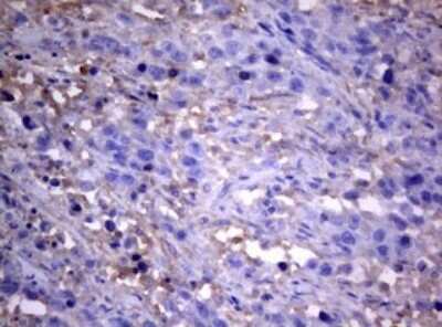 Immunohistochemistry: PIK3C2A Antibody (OTI3H2) [NBP2-46395]