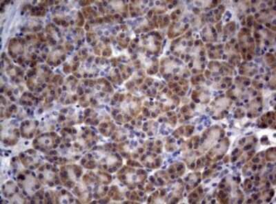 Immunohistochemistry: PIK3C2A Antibody (OTI3H2) [NBP2-46395]