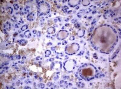 Immunohistochemistry: PIK3C2A Antibody (OTI3H2) [NBP2-46395]