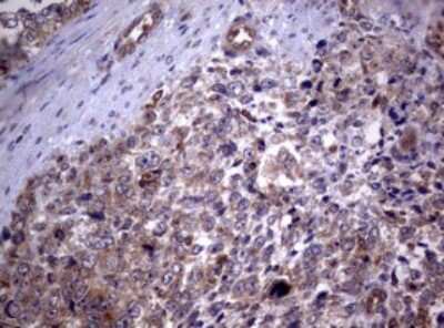 Immunohistochemistry: PIK3C2A Antibody (OTI3H2) [NBP2-46395]