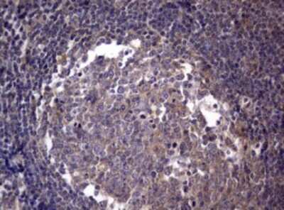 Immunohistochemistry: PIK3C2A Antibody (OTI3H2) [NBP2-46395]