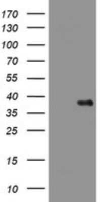 Western Blot: PIK3C2A Antibody (OTI3H2) [NBP2-46395]