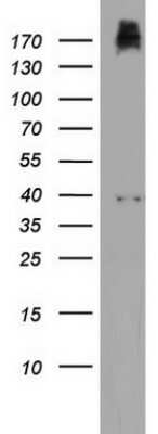 Western Blot: PIK3C2A Antibody (OTI3H2) [NBP2-46395]