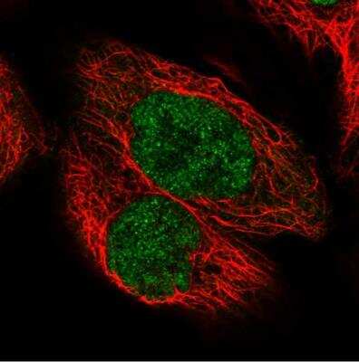 Immunocytochemistry/ Immunofluorescence: PIK3C2A Antibody [NBP1-80909]