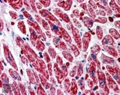 Immunohistochemistry-Paraffin: PIK3C2A Antibody [NB300-855]