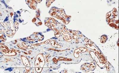 Immunohistochemistry-Paraffin: PIK3C2A Antibody [NB300-855]