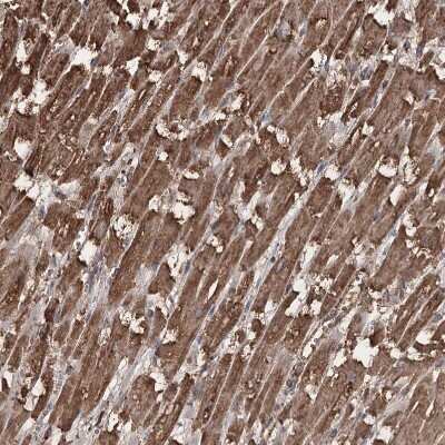 Immunohistochemistry-Paraffin: PIK3C2A Antibody [NBP1-80908]