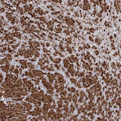 Immunohistochemistry-Paraffin: PIK3C2A Antibody [NBP1-80908]