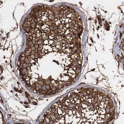 Immunohistochemistry-Paraffin: PIK3C2A Antibody [NBP1-80908]