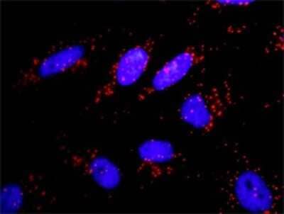 Proximity Ligation Assay: PIK3CA Antibody (3G3) [H00005290-M01]