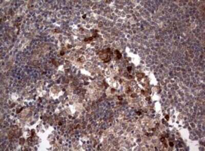 Immunohistochemistry: PIK3CA Antibody (OTI6D9) [NBP2-46403]