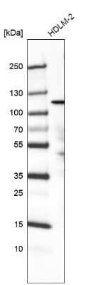 Western Blot: PIK3CA Antibody (CL8345) [NBP3-05502]