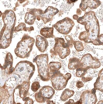 Immunohistochemistry-Paraffin: PIK3CA Antibody (CL8347) [NBP2-88915]