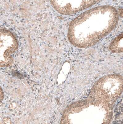 Immunohistochemistry-Paraffin: PIK3CA Antibody (CL8347) [NBP2-88915]