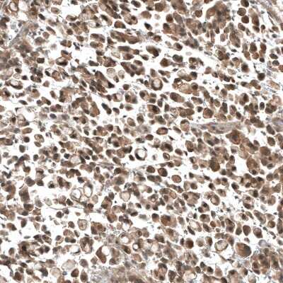 Immunohistochemistry-Paraffin: PIK3CA Antibody (CL8347) [NBP2-88915]