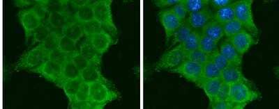 Immunocytochemistry/ Immunofluorescence: PIK3CA Antibody [NBP2-19804]