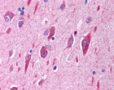 Immunohistochemistry-Paraffin: PIK3CA Antibody [NB100-55408]