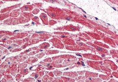 Immunohistochemistry-Paraffin: PIK3CA Antibody [NB100-55408]