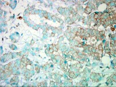 Immunohistochemistry-Paraffin: PIK3CA Antibody [NBP2-19804]