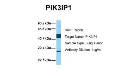 Western Blot: PIK3IP1 Antibody [NBP1-69623]