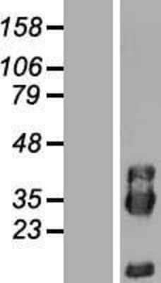 Western Blot: PIK3IP1 Overexpression Lysate [NBL1-14419]