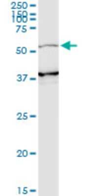 Western Blot: PI 3-Kinase p55 gamma Antibody (2F8) [H00008503-M02]