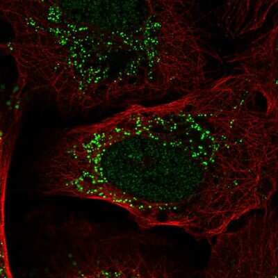 Immunocytochemistry/ Immunofluorescence: PI 3-Kinase p55 gamma Antibody [NBP2-57974]