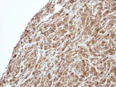 Immunohistochemistry-Paraffin: PI 3-Kinase p55 gamma Antibody [NBP1-32636]