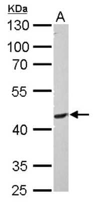 Western Blot: PI 3-Kinase p55 gamma Antibody [NBP1-32636]
