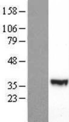 Western Blot: PI 3-Kinase p55 gamma Overexpression Lysate [NBP2-09395]