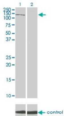 Western Blot: PIK3R4 Antibody (1D4) [H00030849-M01]