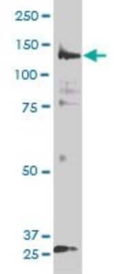 Western Blot: PIK3R4 Antibody (1D4) [H00030849-M01]