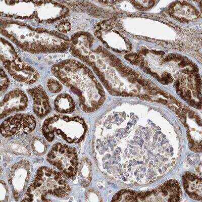 Immunohistochemistry-Paraffin: PIK3R4 Antibody [NBP1-82451]